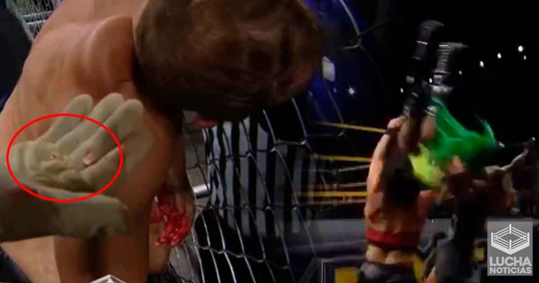 Ocurren 2 accidentes en WWE NXT