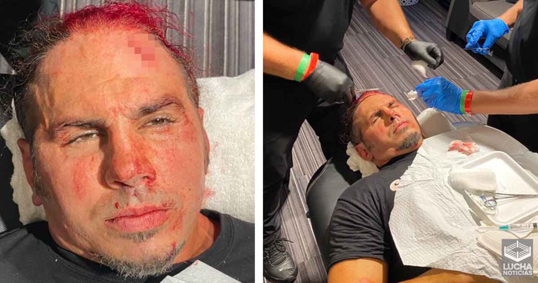 Sammy Guevara es regañado por lastimar a Matt Hardy Sammy Guevara es regañado por lastimar a Matt Hardy