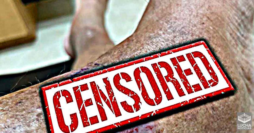 Jim Ross comparte fuerte foto de su cancer de piel